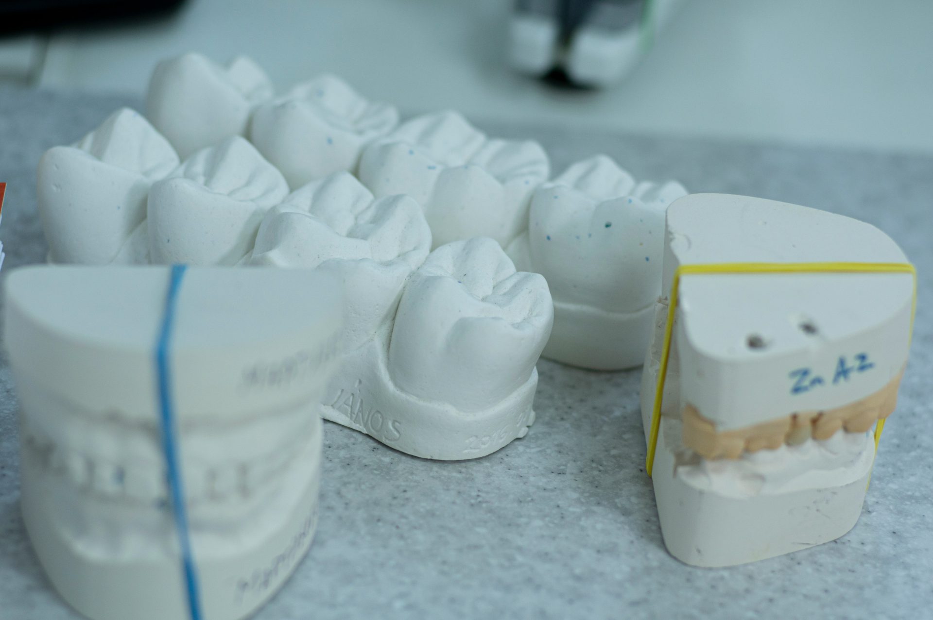 Modelos dentales en cerámica blanca