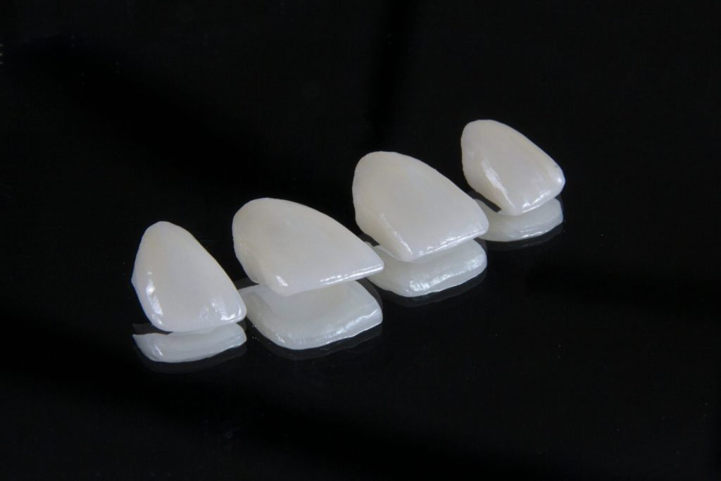 Piezas de cerámica blanca brillante